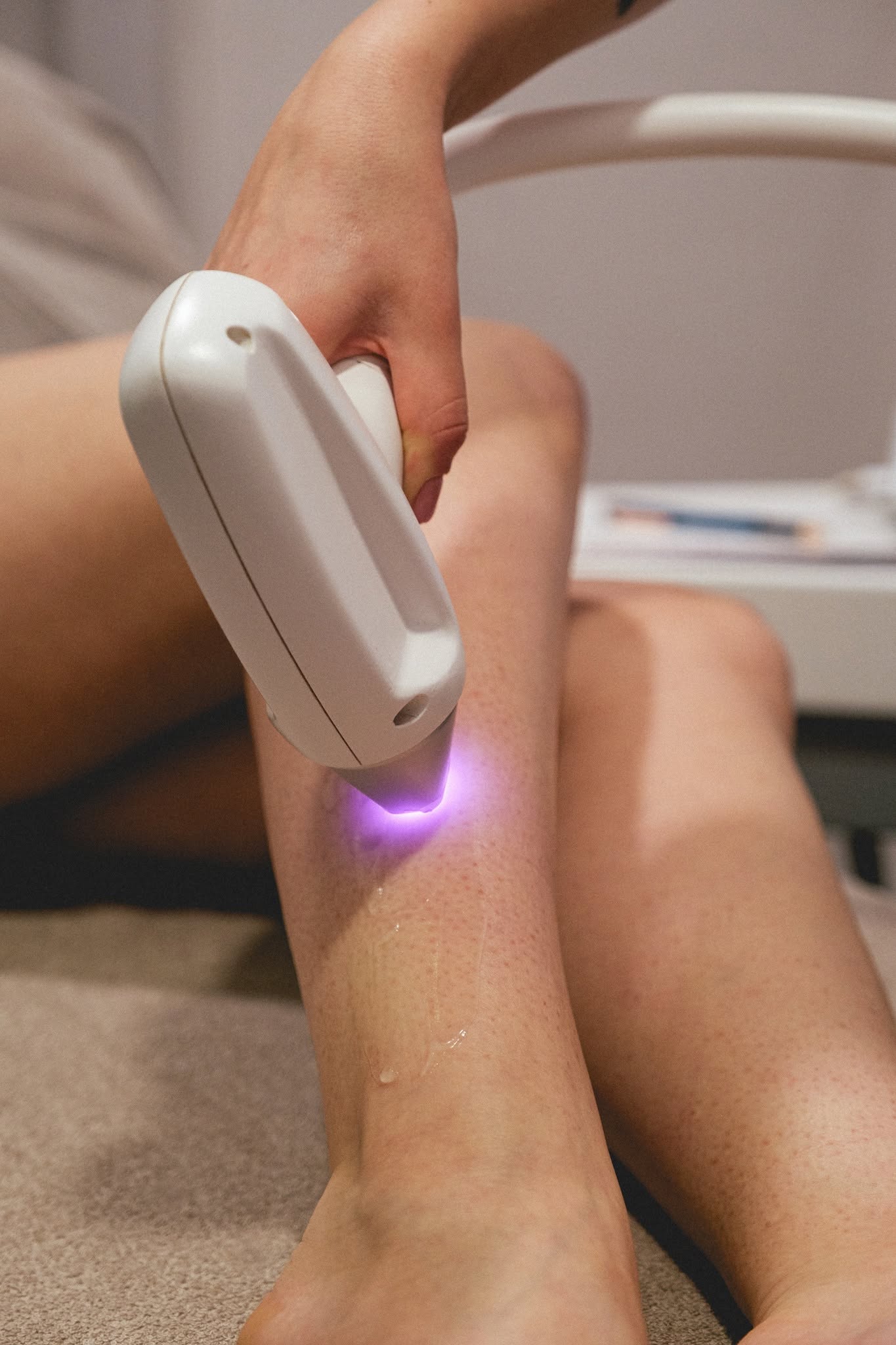 Trattamento laser EPIL3DSYSTEM sulla caviglia con luce viola